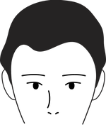 Male pattern stage 1