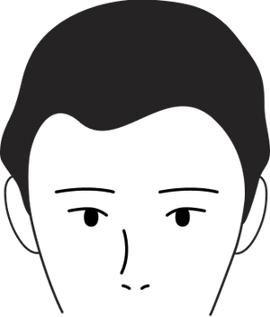 Male pattern stage 1