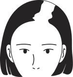 Female pattern stage 4