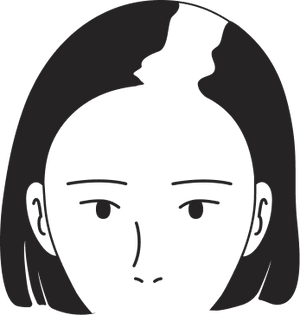 Female pattern stage 4