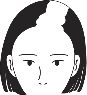 Female pattern stage 5