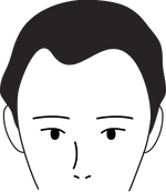 Male pattern stage 2