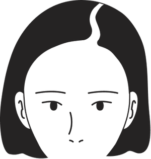 Female pattern stage 2