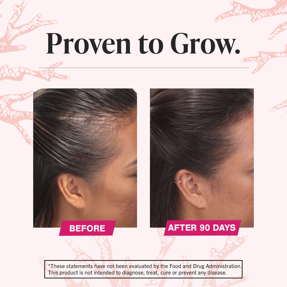 before and after image of the side of a woman hair after using Viviscal hair growth supplement
