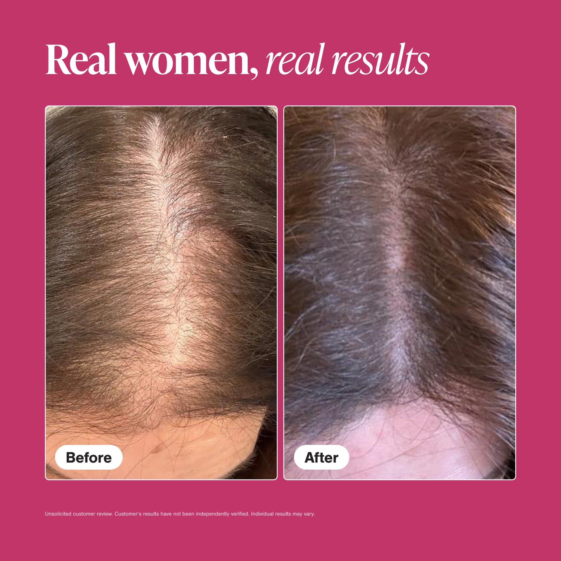before and after hair growth supplement results