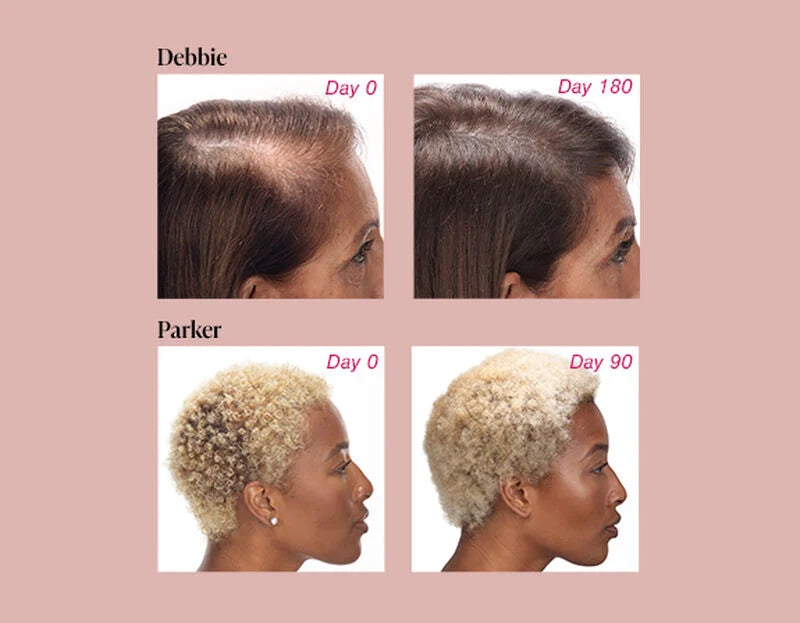 before and after image of two different hair type with Viviscal hair essential collection